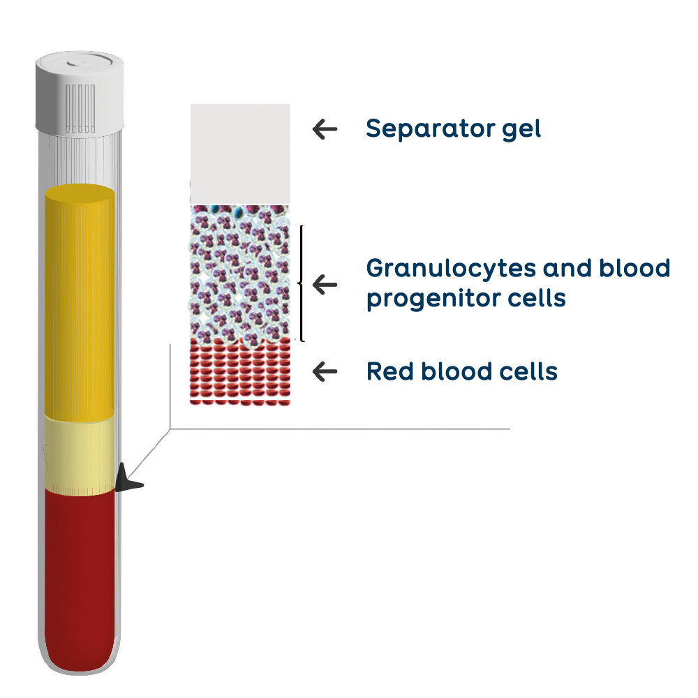 THT tube Regen Lab Tube