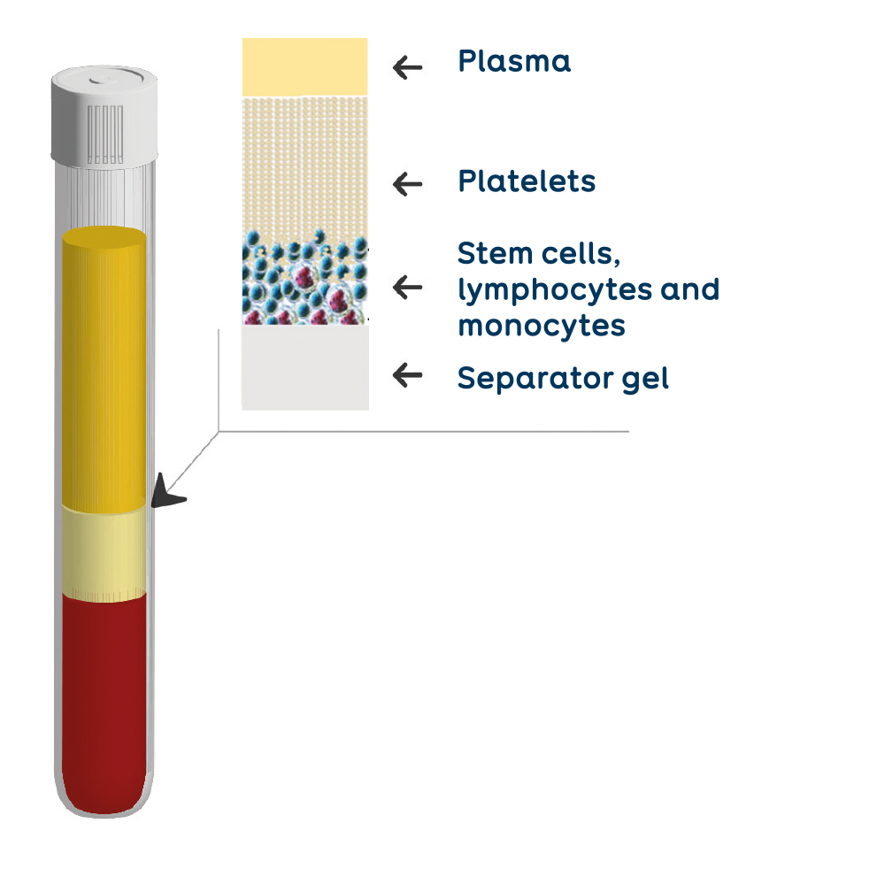 THT tube1 plasma composition